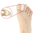 Bunions Gel Toe Separators for Overlapping Toes